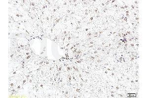 Formalin-fixed and paraffin embedded rat liver tissue labeled with Anti-Bcl-2 Polyclonal Antibody, Unconjugated (ABIN723920) 1:400 followed by conjugation to the secondary antibody and DAB staining (Bcl-2 抗体  (AA 101-160))