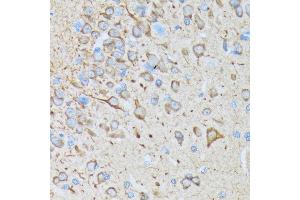 Immunohistochemistry (IHC) image for anti-Calcium/calmodulin-Dependent Protein Kinase II beta (CAMK2B) antibody (ABIN1679768)