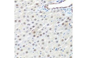 Immunohistochemistry of paraffin-embedded rat liver using PRPF19 antibody (ABIN6293423) at dilution of 1:100 (40x lens). (PRP19 抗体)