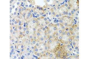 Immunohistochemistry of paraffin-embedded Mouse kidney using PEX3 Polyclonal Antibody at dilution of 1:100 (40x lens). (PEX3 抗体)