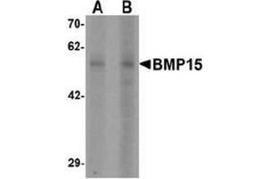 Western blot analysis of BMP15 in 3T3 cell lysate with BMP15 Antibody  at (A) 1 and (B) 2 µg/ml (BMP15 抗体  (N-Term))