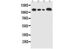 Anti-human CEACAM5 antibody, Western blotting Lane 1: Recombinant Human CEA Protein 5ng Lane 2: Recombinant Human CEA Protein 2 (CEACAM5 抗体  (full length))