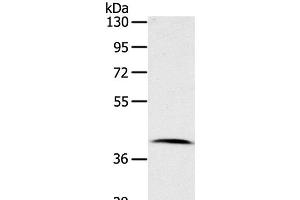 Western Blot analysis of Human lymphoma tissue using CDK10 Polyclonal Antibody at dilution of 1:100 (CDK10 抗体)