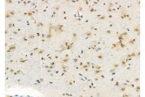ABIN6263269 and ABIN6272345 at 1/100 staining Rat brain tissue by IHC-P. (DUSP4 抗体  (Internal Region))