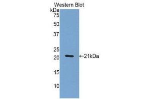 Western Blotting (WB) image for anti-Orosomucoid 1 (ORM1) (AA 20-186) antibody (ABIN3207789) (ORM1 抗体  (AA 20-186))