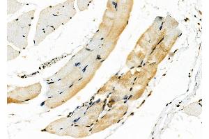 ABIN6263464 and ABIN6278377 at 1/100 staining Rat skin tissue by IHC-P.