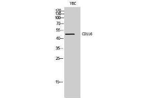 Western Blotting (WB) image for anti-Colony Stimulating Factor 2 Receptor, Alpha, Low-Affinity (Granulocyte-Macrophage) (CSF2RA) (Internal Region) antibody (ABIN3183730) (CSF2RA 抗体  (Internal Region))