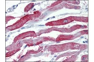 Immunohistochemistry Image: Human Heart: Formalin-Fixed, Paraffin-Embedded (FFPE) (Junctophilin 2 抗体  (C-Term))