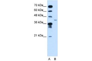 MFAP3L antibody used at 2. (MFAP3L 抗体  (N-Term))