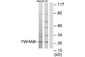 Western blot analysis of extracts from HepG2 cells and Jurkat cells, using 14-3-3 β antibody. (YWHAB 抗体)
