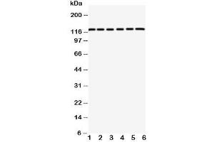 Western blot testing of CAR antibody and rat samples 1: pancreas;  2: brain;  3: heart; and human samples 4: HeLa;  5: 293T;  6: COLO320 cell lysate. (Coxsackie Adenovirus Receptor 抗体  (C-Term))