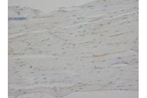 Immunohistochemical analysis of paraffin embedded rat tissue sections (cardiac muscle) using CRP antibody (CRP 抗体  (N-Term))