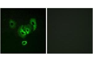 Immunofluorescence analysis of A549 cells, using STEA2 Antibody. (STEAP2 抗体  (AA 431-480))