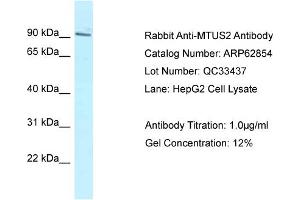 Western Blotting (WB) image for anti-Microtubule-associated Tumor Suppressor Candidate 2 (MTUS2) (C-Term) antibody (ABIN2789269) (CAZIP 抗体  (C-Term))