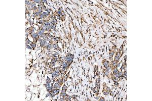 IHC analysis of SUCLG2 using anti-SUCLG2 antibody (ABIN7601694).