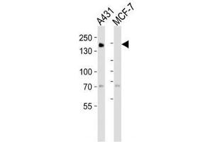 Western blot analysis of lysate from A431, MCF-7 cell line (left to right) using EGF Receptor antibody at 1:1000 for each lane. (EGFR 抗体  (AA 1163-1191))