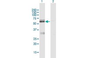 Western Blot analysis of LMF1 expression in transfected 293T cell line by LMF1 MaxPab polyclonal antibody. (LMF1 抗体  (AA 1-567))