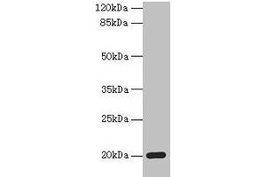 Western blot All lanes: MPV17 antibody at 2 μg/mL + Mouse heart tissue Secondary Goat polyclonal to rabbit IgG at 1/10000 dilution Predicted band size: 20 kDa Observed band size: 20 kDa (MPV17 抗体  (AA 1-176))