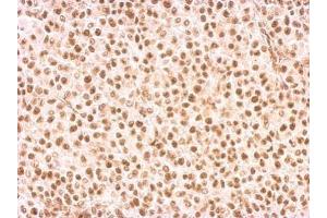 IHC-P Image Rad9 antibody detects RAD9A protein at nucleus on HBL435 xenograft by immunohistochemical analysis.