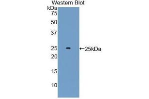Western Blotting (WB) image for anti-Androgen Receptor (AR) (AA 491-679) antibody (ABIN1174429) (Androgen Receptor 抗体  (AA 491-679))