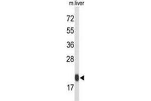 Western blot analysis of Glutathione peroxidase 1 / GPX1 (arrow) in mouse liver tissue lysates (35ug/lane) using Glutathione peroxidase 1 / GPX1  Antibody (C-term). (Glutathione Peroxidase 1 抗体  (C-Term))