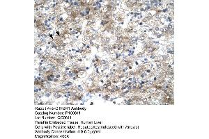 Immunohistochemistry (IHC) image for anti-General Transcription Factor IIH, Polypeptide 1, 62kDa (GTF2H1) (N-Term) antibody (ABIN2792595)