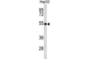 Western Blotting (WB) image for anti-Fibulin 4 (FBLN4) antibody (ABIN3004104) (FBLN4 抗体)