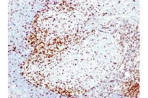 Formalin-fixed, paraffin-embedded human Tonsil stained with ZAP70 Mouse Monoclonal Antibody (2F3. (ZAP70 抗体  (AA 1-254))