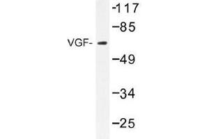 Image no. 1 for anti-VGF Nerve Growth Factor Inducible (VGF) antibody (ABIN317924) (VGF 抗体)