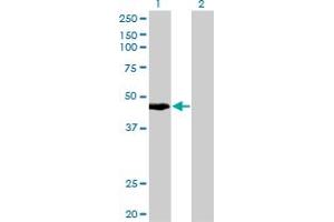 Keratin 34 antibody  (AA 337-436)