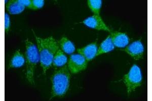 IF analysis of ARAF using anti-ARAF antibody (ABIN6719439).