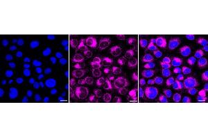 Immunocytochemical staining of HT- cells with NSDHL antibody (ABIN7799539), 1:1,000). (Recombinant NSDHL 抗体)