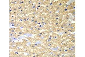 Immunohistochemistry of paraffin-embedded Mouse heart using RPH3A Polyclonal Antibody at dilution of 1:100 (40x lens). (RPH3A 抗体)