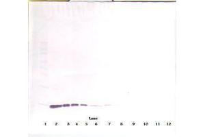Image no. 1 for anti-Interleukin 2 (IL2) antibody (ABIN465098) (IL-2 抗体)