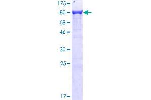 Plastin 3 Protein (PLS3) (AA 1-630) (GST tag)