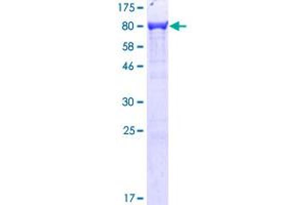 Plastin 3 Protein (PLS3) (AA 1-630) (GST tag)