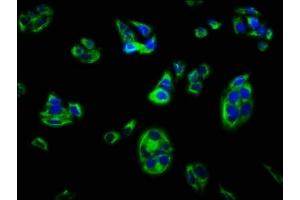 Immunofluorescence staining of PC-3 cells with ABIN7150080 at 1:100, counter-stained with DAPI. (DLG5 抗体  (AA 1580-1704))