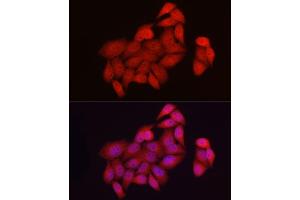 Immunofluorescence analysis of HeLa cells using NUR77 Rabbit pAb (ABIN6134860, ABIN6144825, ABIN6144828 and ABIN6217265) at dilution of 1:50 (40x lens). (NR4A1 抗体)