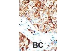 Immunohistochemistry (IHC) image for anti-Ubiquilin 1 (UBQLN1) antibody (ABIN2995228) (Ubiquilin 1 抗体)