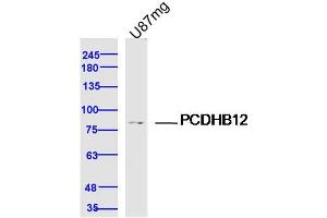 U87MG lysates probed with PCDHB12 Polyclonal Antibody, Unconjugated  at 1:300 dilution and 4˚C overnight incubation. (PCDHB12 抗体  (AA 121-220))