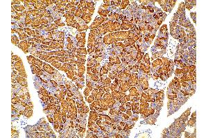 ABIN6256775 and ABIN6267452 at 1/100 staining mouse pancreatic tissue sections by IHC-P.