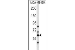 PTDSS2 Antibody (N-term) (ABIN656975 and ABIN2846159) western blot analysis in MDA-M cell line lysates (35 μg/lane). (PTDSS2 抗体  (N-Term))