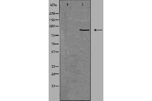 Western blot analysis of extracts from Jurkat cells, using NOX5 antibody. (NOX5 抗体  (C-Term))