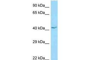 WB Suggested Anti-APOL1 Antibody Titration: 1. (APOL1 抗体  (N-Term))