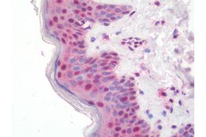 Immunohistochemistry (IHC) image for anti-Zinc Finger, Matrin Type 2 (ZMAT2) antibody (Biotin) (ABIN1955968)
