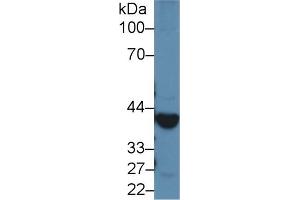 Detection of ADH1 in Rat Liver lysate using Polyclonal Antibody to Alcohol Dehydrogenase 1 (ADH1) (ADH1 抗体  (AA 169-370))