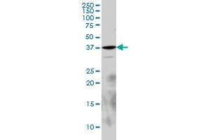 EPM2A monoclonal antibody (M02), clone 6C6 Western Blot analysis of EPM2A expression in PC-12 . (EPM2A 抗体  (AA 101-199))