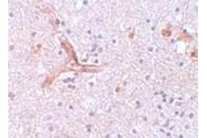 Immunohistochemistry (IHC) image for anti-Zinc Finger CCCH-Type Containing 12C (ZC3H12C) (N-Term) antibody (ABIN1031674) (ZC3H12C 抗体  (N-Term))