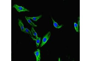 Immunofluorescent analysis of Hela cells using ABIN7145796 at dilution of 1:100 and Alexa Fluor 488-congugated AffiniPure Goat Anti-Rabbit IgG(H+L) (BAZ2A 抗体  (AA 97-266))