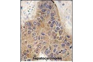 Immunohistochemistry (Paraffin-embedded Sections) (IHC (p)) image for anti-STIP1 Homology and U-Box Containing Protein 1 (STUB1) (AA 203-231), (C-Term) antibody (ABIN390386)